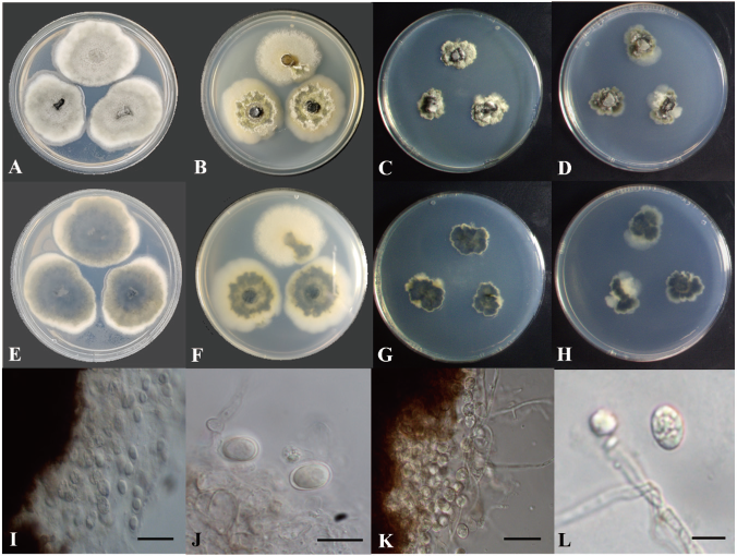 https://www.kjmycology.or.kr/images/KJOM/images/N0320490108_image/Figure_KJOM_49_01_08_F1.png