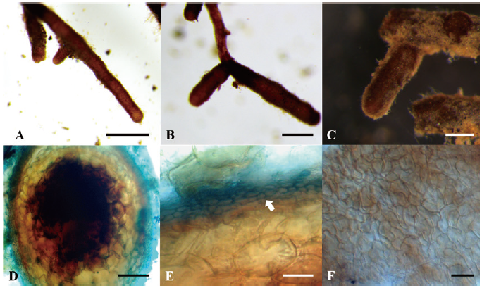 https://www.kjmycology.or.kr/images/KJOM/images/N0320490110_image/Figure_KJOM_49_01_10_F4.png