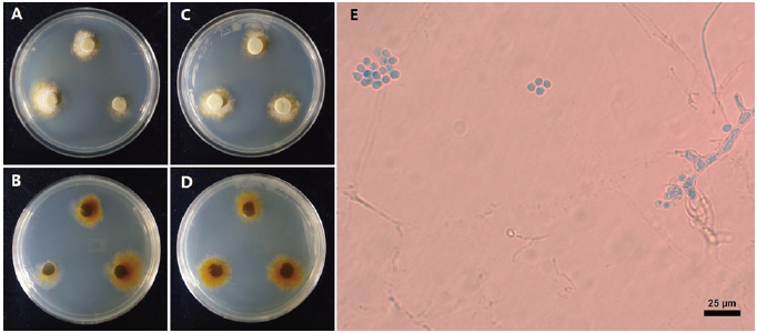 https://www.kjmycology.or.kr/images/KJOM/images/N0320490113_image/Figure_KJOM_49_01_13_F1.png