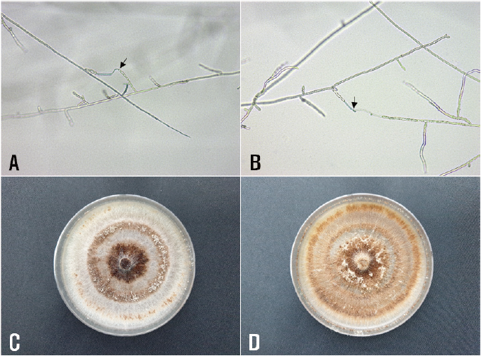 https://www.kjmycology.or.kr/images/KJOM/images/N0320490114_image/Figure_KJOM_49_01_14_F2.png