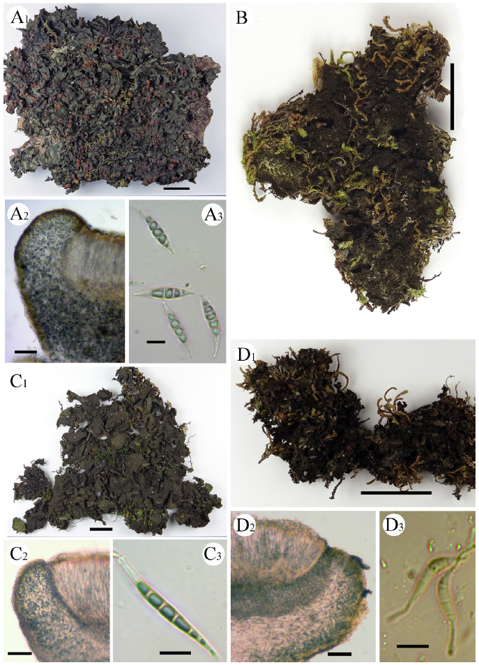 https://www.kjmycology.or.kr/images/KJOM/images/N0320490202_image/Fig_KJOM_49_02_02_F1-2.png