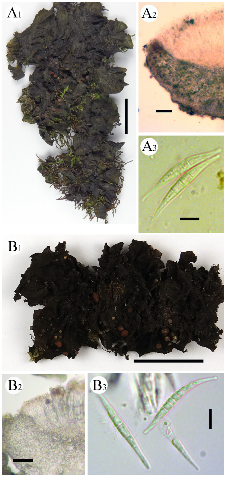 https://www.kjmycology.or.kr/images/KJOM/images/N0320490202_image/Fig_KJOM_49_02_02_F1-3.png