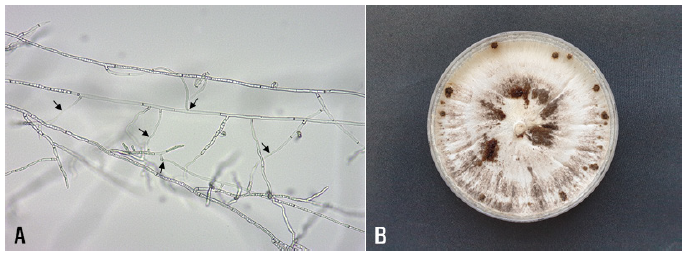 https://www.kjmycology.or.kr/images/KJOM/images/N0320490208_image/Fig_KJOM_49_02_08_F2.png