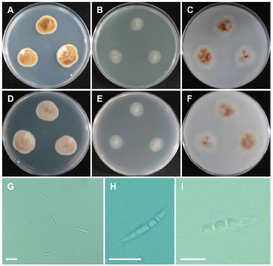 https://www.kjmycology.or.kr/images/KJOM/images/N0320490301_image/Fig_KJOM_49_03_01_F10.png