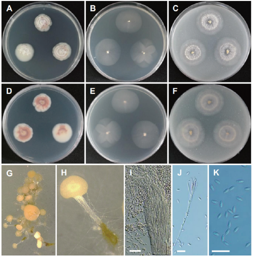 https://www.kjmycology.or.kr/images/KJOM/images/N0320490301_image/Fig_KJOM_49_03_01_F17.png