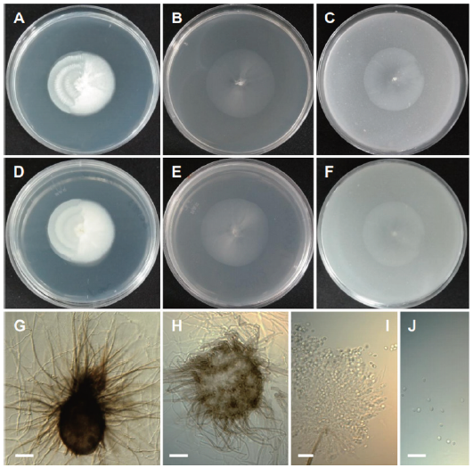 https://www.kjmycology.or.kr/images/KJOM/images/N0320490301_image/Fig_KJOM_49_03_01_F9.png