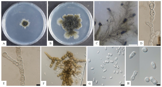 https://www.kjmycology.or.kr/images/KJOM/images/N0320490305_image/Fig_KJOM_49_03_05_F1.png