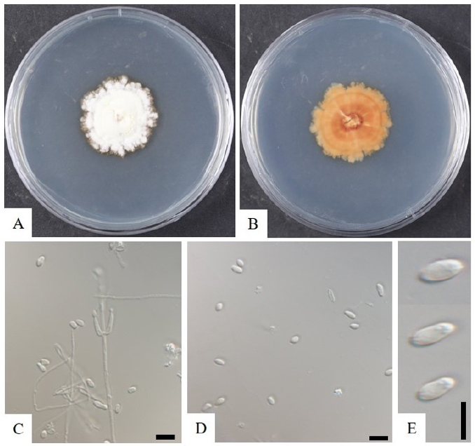 https://www.kjmycology.or.kr/images/KJOM/images/N0320490305_image/Fig_KJOM_49_03_05_F3.png