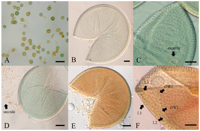 https://www.kjmycology.or.kr/images/KJOM/images/N0320490401_image/Fig_KJOM_49_04_01_F2.png