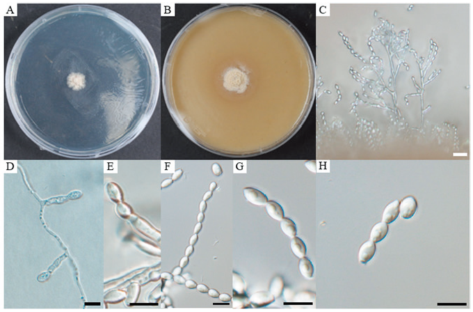 https://www.kjmycology.or.kr/images/KJOM/images/N0320490406_image/Fig_KJOM_49_04_06_F1.png