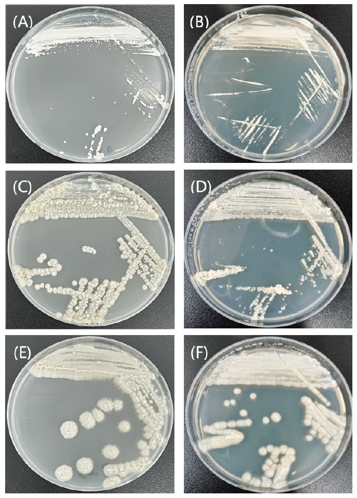 https://www.kjmycology.or.kr/images/KJOM/images/N0320490414_image/Fig_KJOM_49_04_14_F1.png