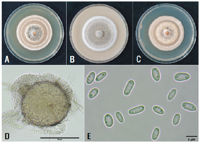 https://www.kjmycology.or.kr/images/KJOM/images/N0320490415_image/Fig_KJOM_49_04_15_F2.png