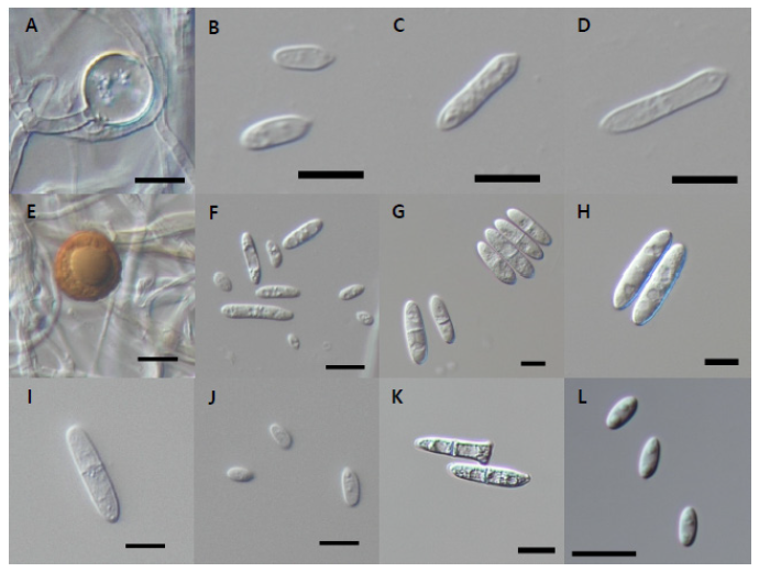 https://www.kjmycology.or.kr/images/KJOM/images/N0320500101_image/Fig_KJOM_50_01_01_F8.png