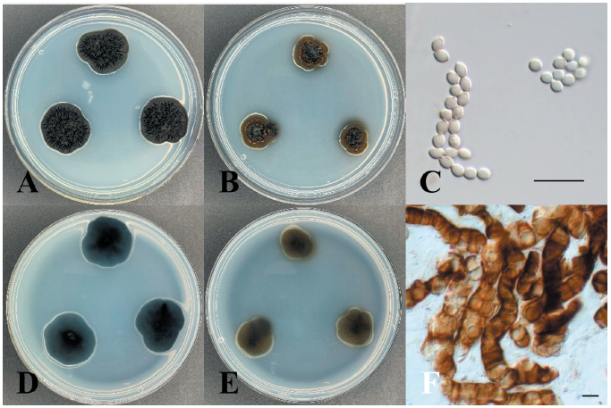 https://www.kjmycology.or.kr/images/KJOM/images/N0320500303_image/Fig_KJOM_50_03_03_F1.png