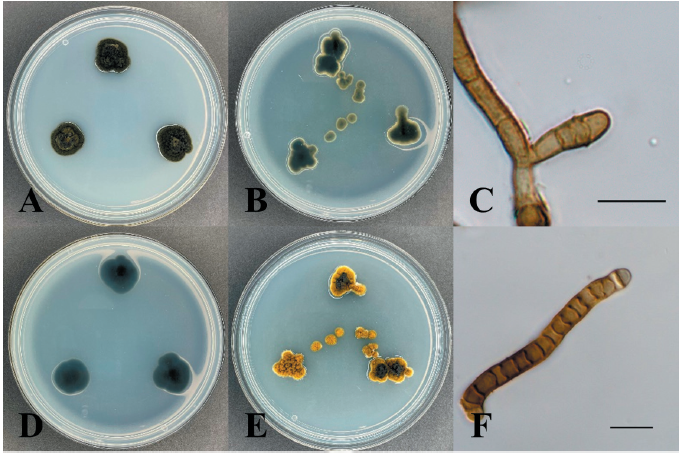https://www.kjmycology.or.kr/images/KJOM/images/N0320500303_image/Fig_KJOM_50_03_03_F3.png