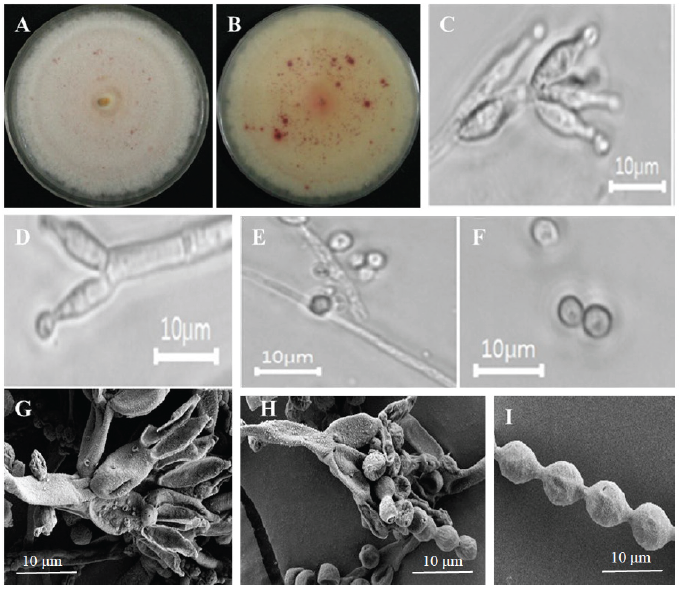 https://www.kjmycology.or.kr/images/KJOM/images/N0320500411_image/Fig_KJOM_50_04_11_F1.png