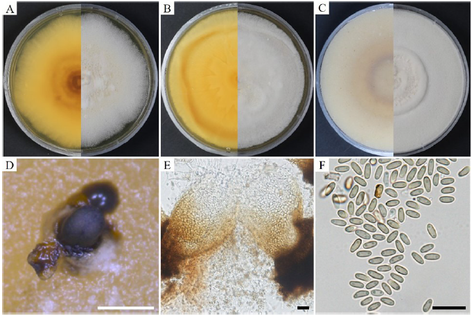 https://www.kjmycology.or.kr/images/KJOM/images/N0320510103_image/Fig_KJOM_51_01_03_F3.png