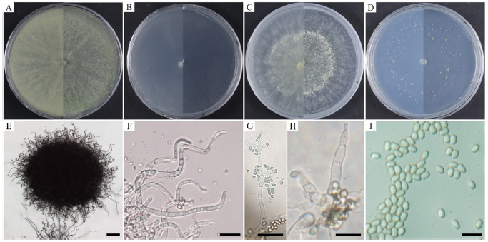 https://www.kjmycology.or.kr/images/KJOM/images/N0320510103_image/Fig_KJOM_51_01_03_F5.png