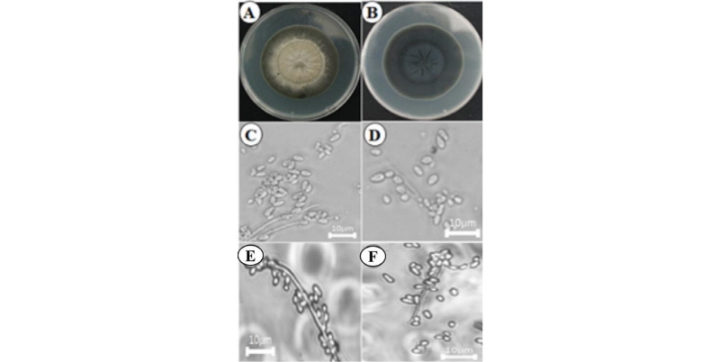 https://www.kjmycology.or.kr/images/kjom/images/N0320460102_image/Figure_kjom_46_01_02_F2.jpg