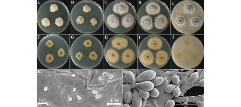 https://www.kjmycology.or.kr/images/kjom/images/N0320460102_image/Figure_kjom_46_01_02_F5.jpg