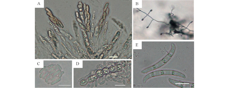 https://www.kjmycology.or.kr/images/kjom/images/N0320460108_image/Figure_kjom_46_01_08_F2.jpg