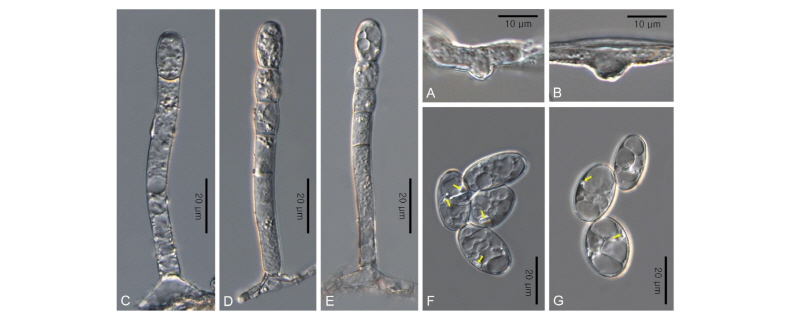 https://www.kjmycology.or.kr/images/kjom/images/N0320460211_image/Figure_kjom_46_02_11_F2.jpg