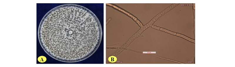 https://www.kjmycology.or.kr/images/kjom/images/N0320460212_image/Figure_kjom_46_02_12_F3.jpg