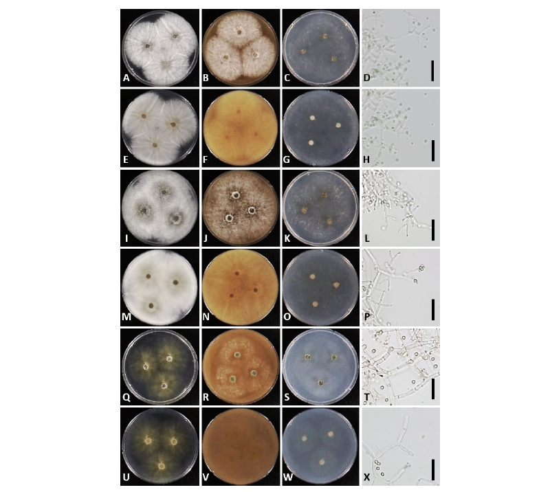 https://www.kjmycology.or.kr/images/kjom/images/N0320460302_image/Figure_kjom_46_03_02_F3.jpg