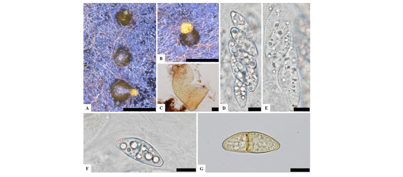 https://www.kjmycology.or.kr/images/kjom/images/N0320460303_image/Figure_kjom_46_03_03_F2.jpg
