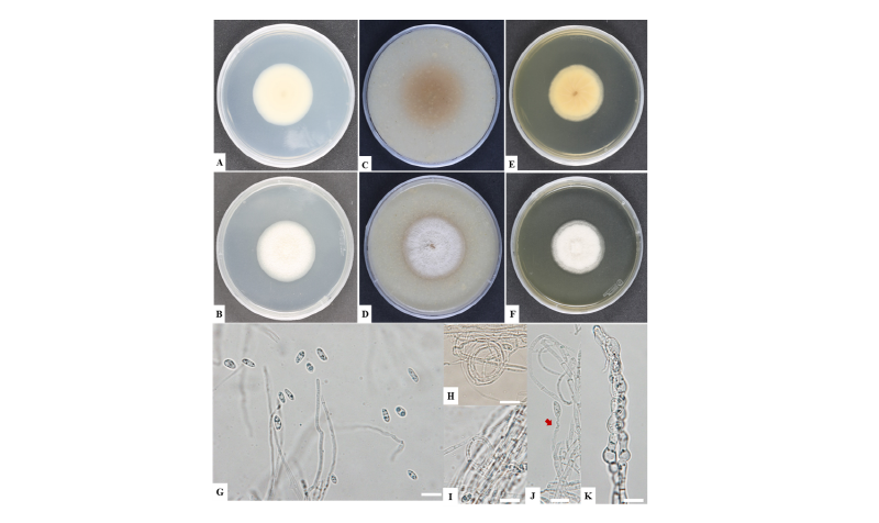 https://www.kjmycology.or.kr/images/kjom/images/N0320460315_image/Figure_kjom_46_03_15_F1.jpg