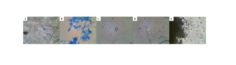 https://www.kjmycology.or.kr/images/kjom/images/N0320460401_image/Figure_kjom_46_04_01_F3.jpg