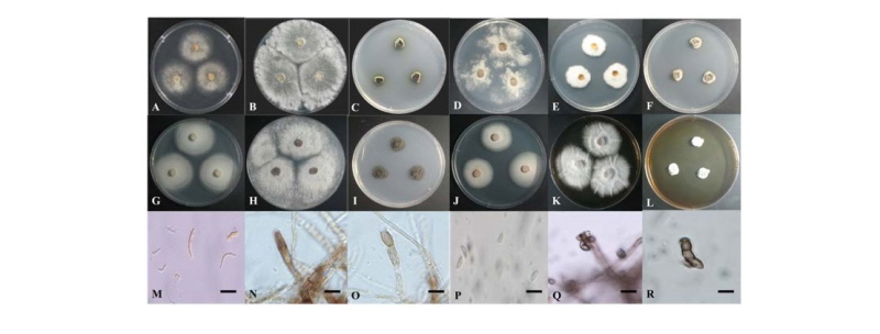 https://www.kjmycology.or.kr/images/kjom/images/N0320460406_image/Figure_kjom_46_04_06_F1.jpg