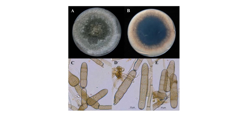 https://www.kjmycology.or.kr/images/kjom/images/N0320460411_image/Figure_kjom_46_04_11_F3.jpg