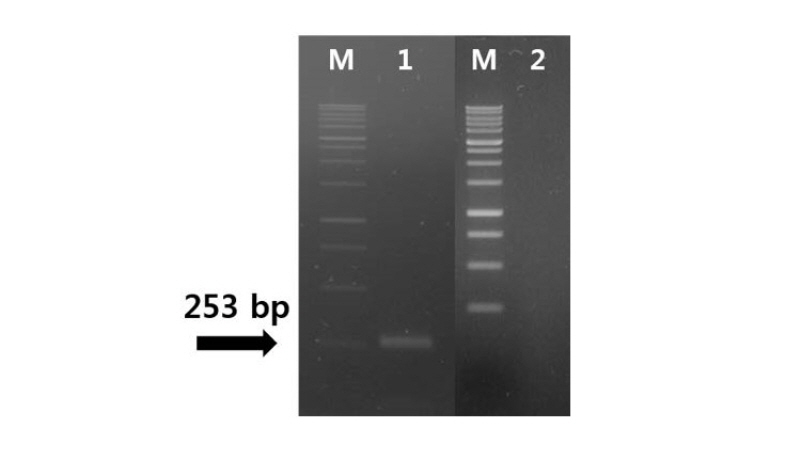 https://www.kjmycology.or.kr/images/kjom/images/N0320460412_image/Figure_kjom_46_04_12_F7.jpg