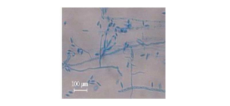 https://www.kjmycology.or.kr/images/kjom/images/N0320460413_image/Figure_kjom_46_04_13_F4.jpg