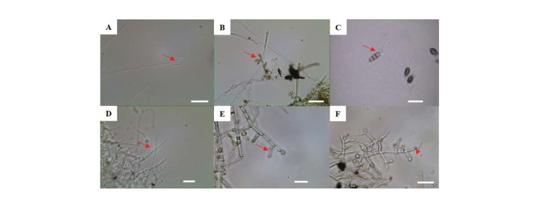 https://www.kjmycology.or.kr/images/kjom/images/N0320460415_image/Figure_kjom_46_04_15_F3.jpg