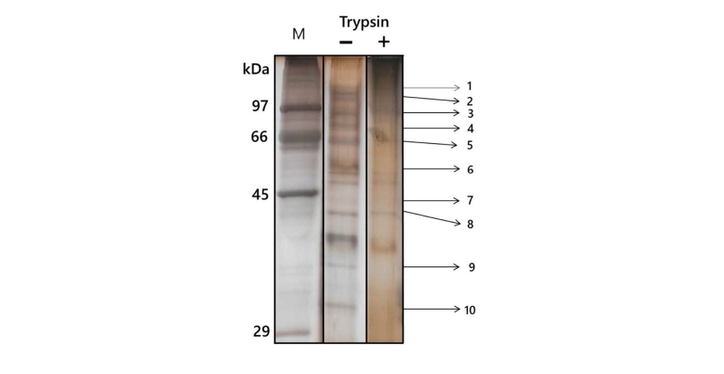 https://www.kjmycology.or.kr/images/kjom/images/N0320460417_image/Figure_kjom_46_04_17_F5.jpg