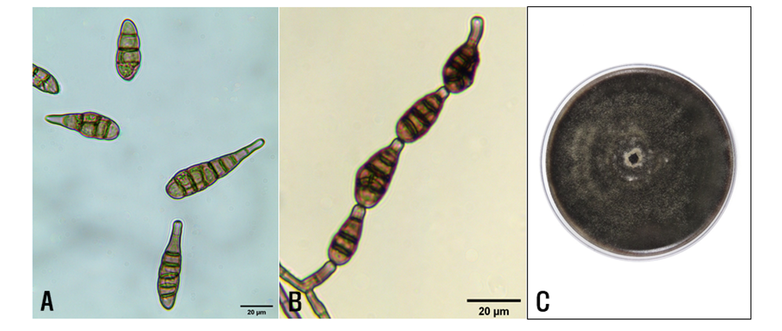 https://www.kjmycology.or.kr/images/kjom/images/N0320480401_image/Figure_KJOM_48_04_01_F2.png