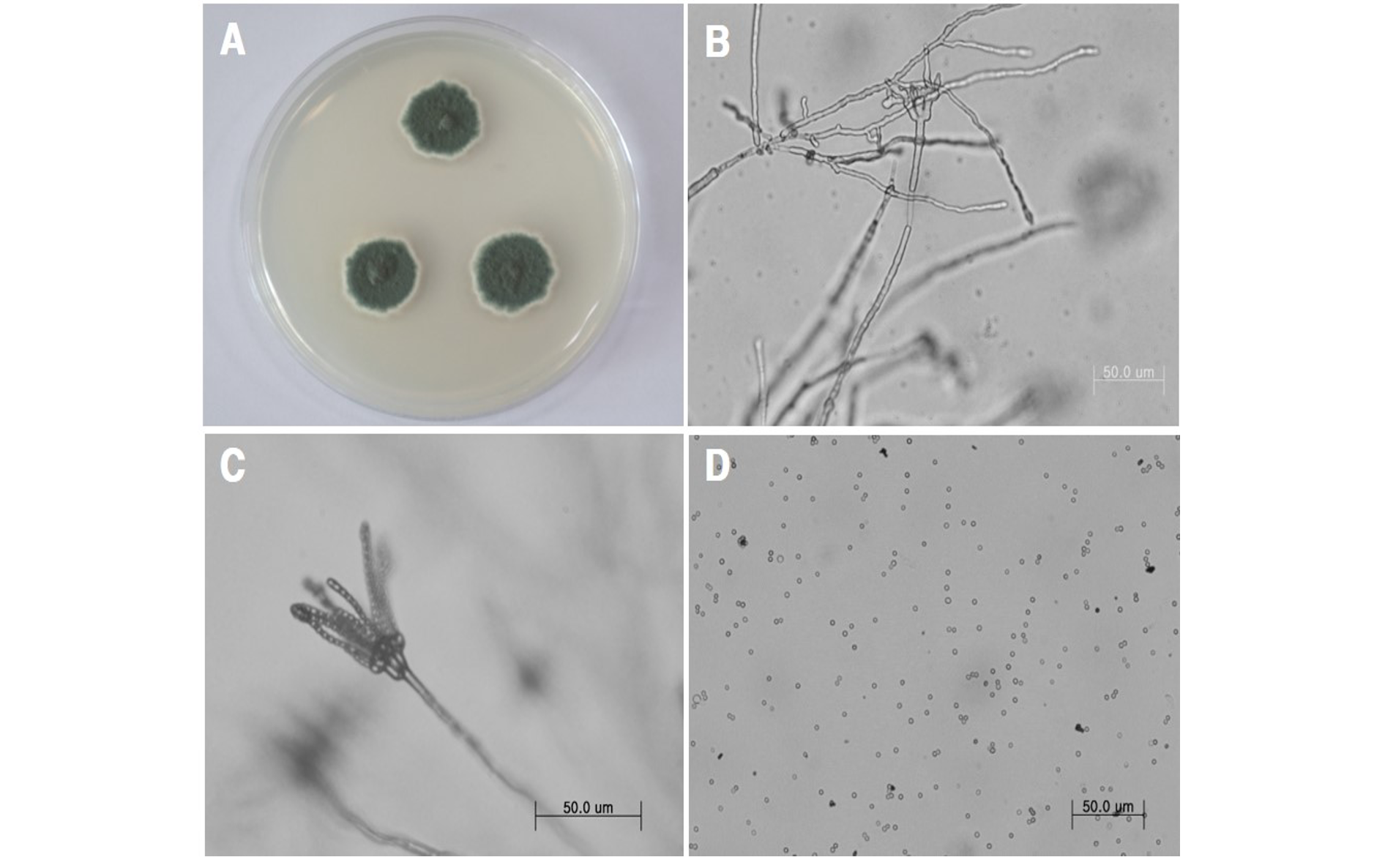 https://www.kjmycology.or.kr/images/kjom/images/N0320480404_image/Figure_KJOM_48_04_04_F2.png