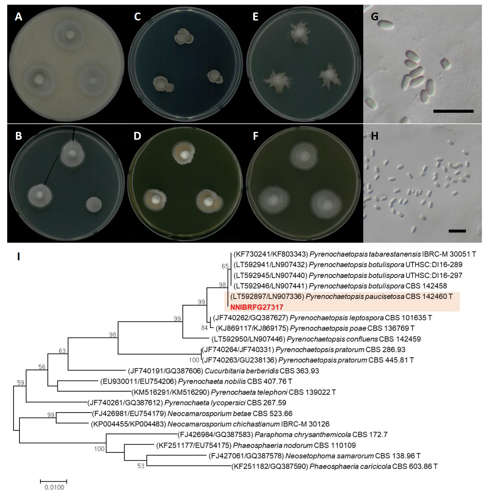 https://www.kjmycology.or.kr/images/kjom/images/N0320480407_image/Figure_KJOM_48_04_07_F5.png
