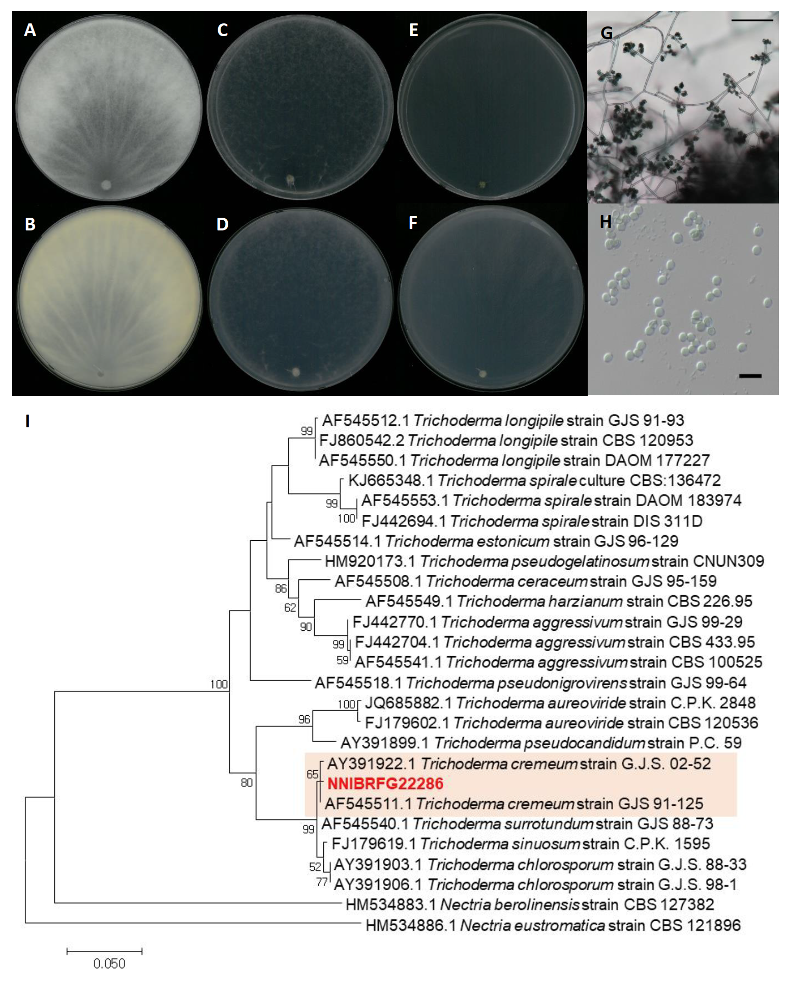 https://www.kjmycology.or.kr/images/kjom/images/N0320480407_image/Figure_KJOM_48_04_07_F8.png