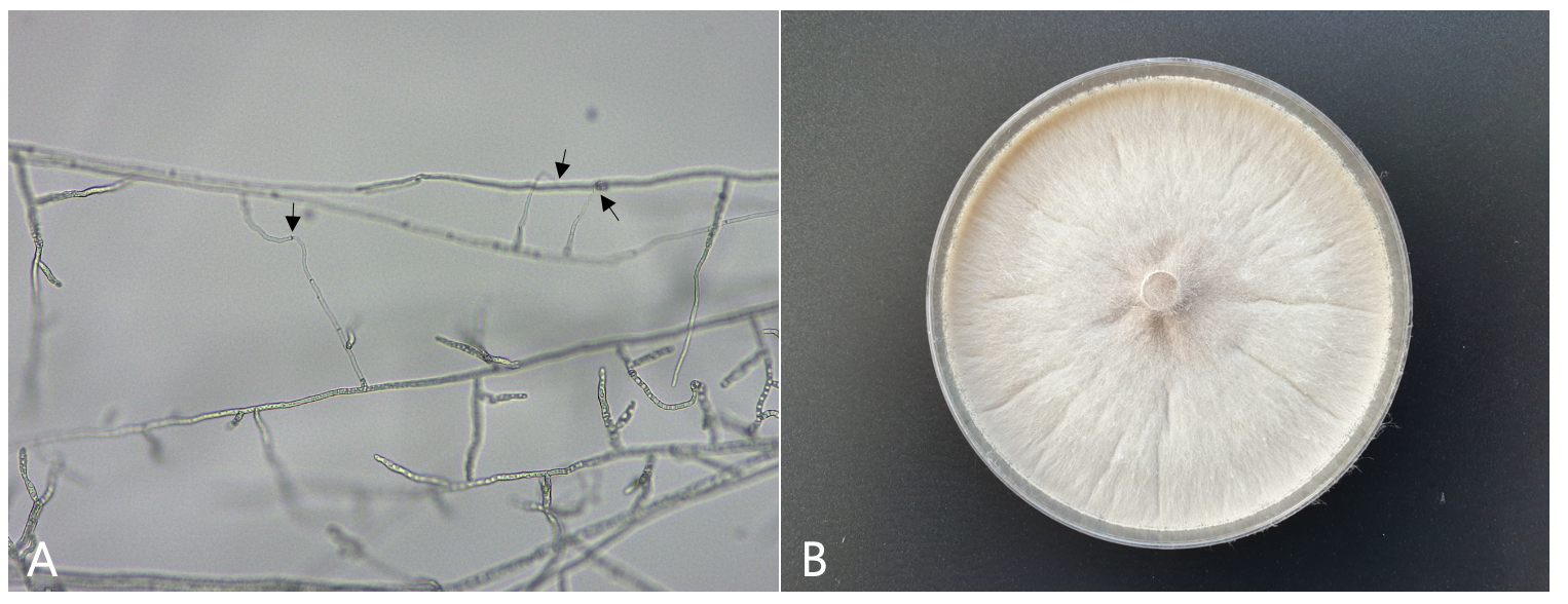 https://www.kjmycology.or.kr/images/kjom/images/N0320480416_image/Figure_KJOM_48_04_16_F2.png
