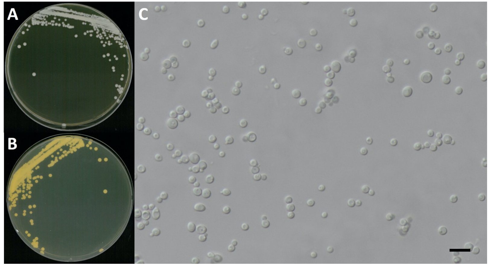 https://www.kjmycology.or.kr/images/kjom/images/N0320480417_image/Figure_KJOM_48_04_17_F4.png
