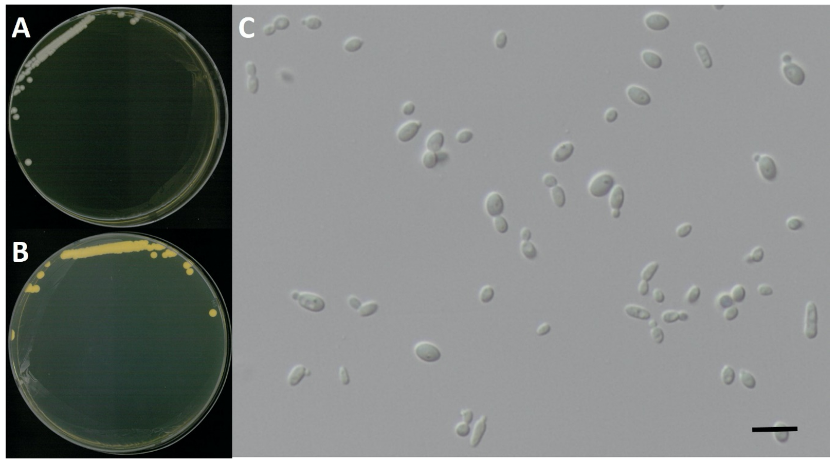 https://www.kjmycology.or.kr/images/kjom/images/N0320480417_image/Figure_KJOM_48_04_17_F5.png