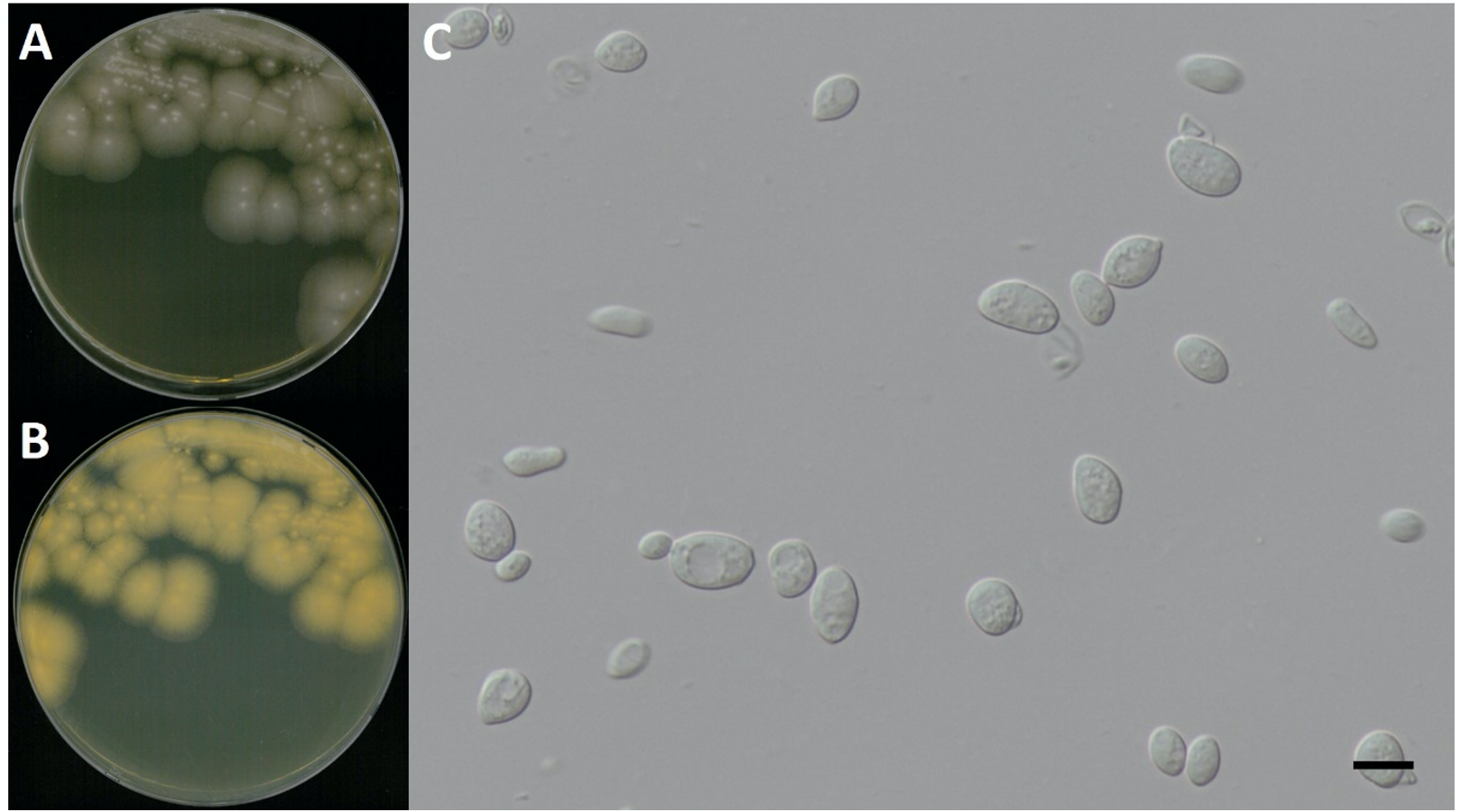 https://www.kjmycology.or.kr/images/kjom/images/N0320480417_image/Figure_KJOM_48_04_17_F8.png